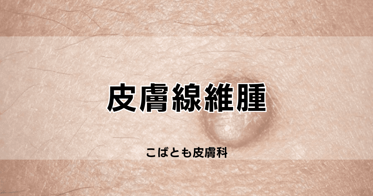 軟性線維腫 soft fibroma治療経過 – 医療法人 双英会 YUKI皮フ科形成外科一宮市時之島の皮膚科、形成外科