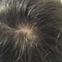 ヘアアレンジの注意点髪のおしゃれと健康カミわざ