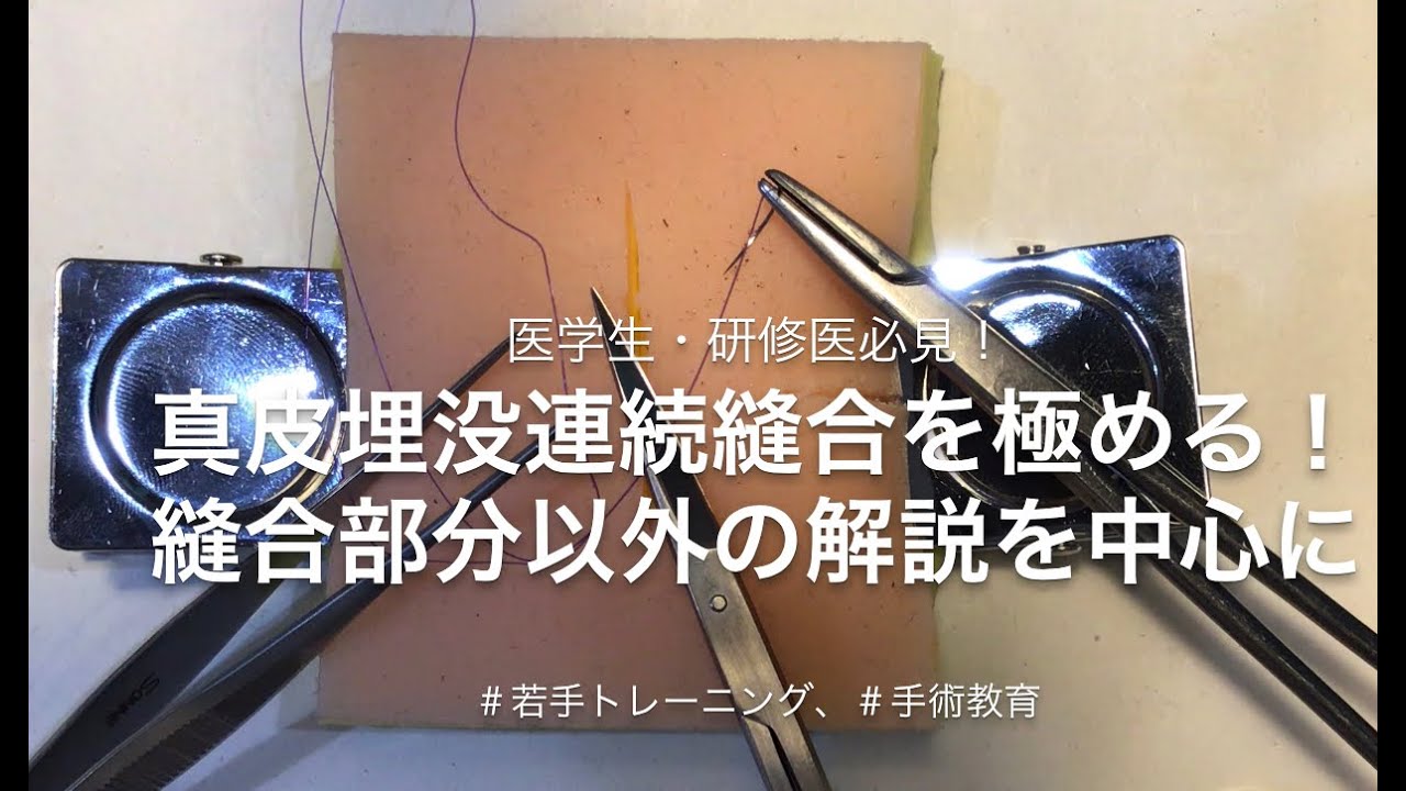 患者教育：縫合とステープル 簡易- UpToDate