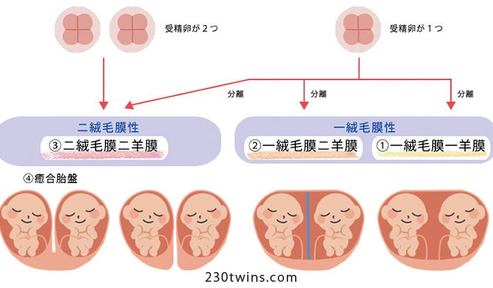 一絨毛膜一羊膜双胎とはTikTok