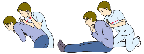 心停止時の前胸部叩打について原因不明と戦う総合診療医ドクターP