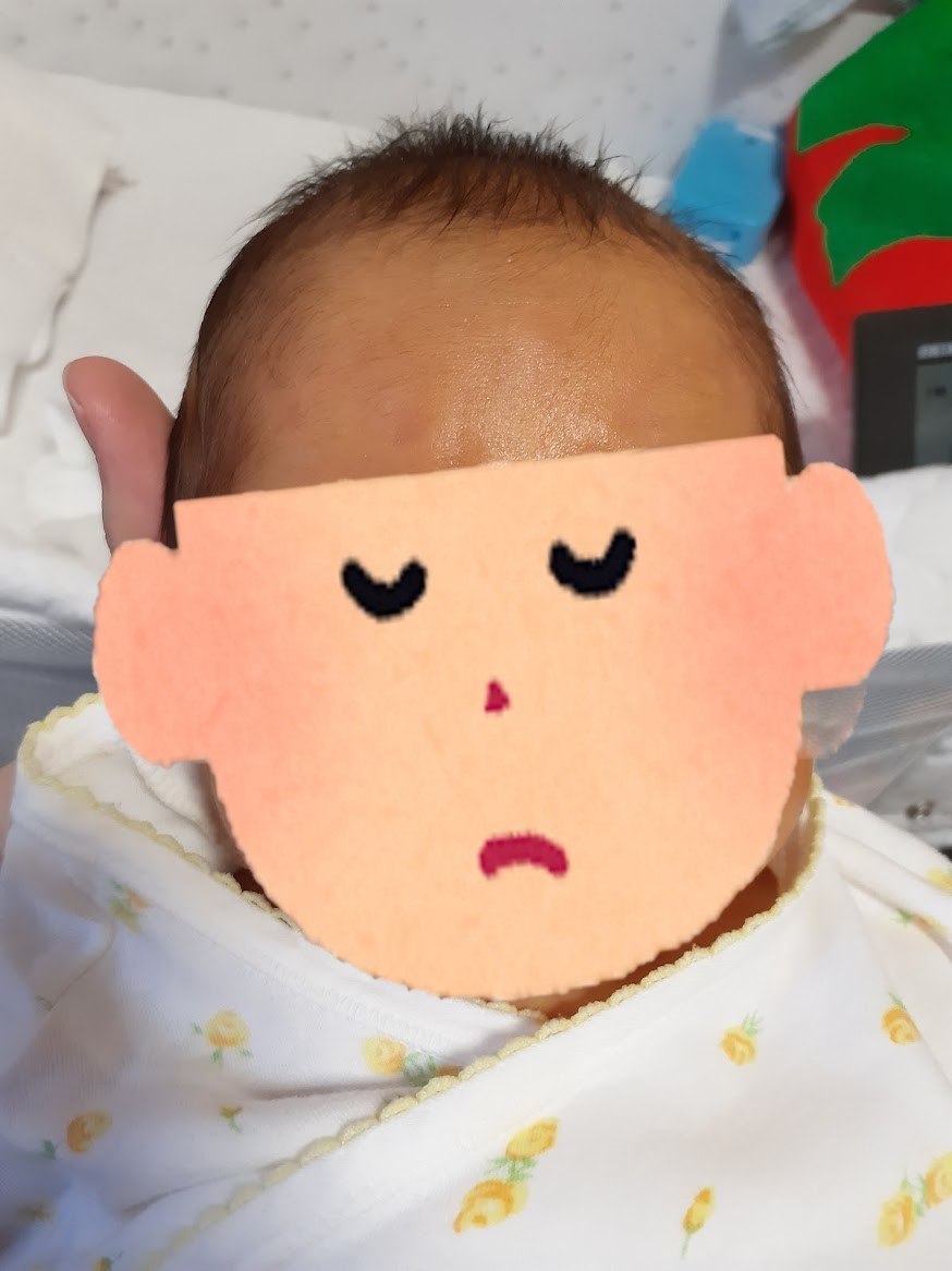 黄疸 赤ちゃんの写真素材 - PIXTA