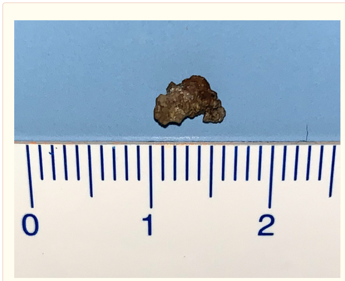 扁桃の病気千葉西総合病院