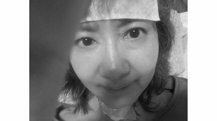 帯状疱疹の症状と原因とは - ゆかい整体