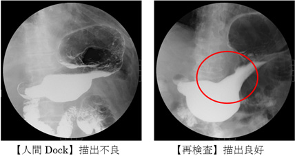 胃がん検診 上部消化管検査 をご希望される方へ春回会クリニック・健診センター 旧：井上病院健診センター