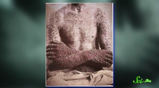 気持ち悪くな～い！！！エビのつぶや記カニのぼや記