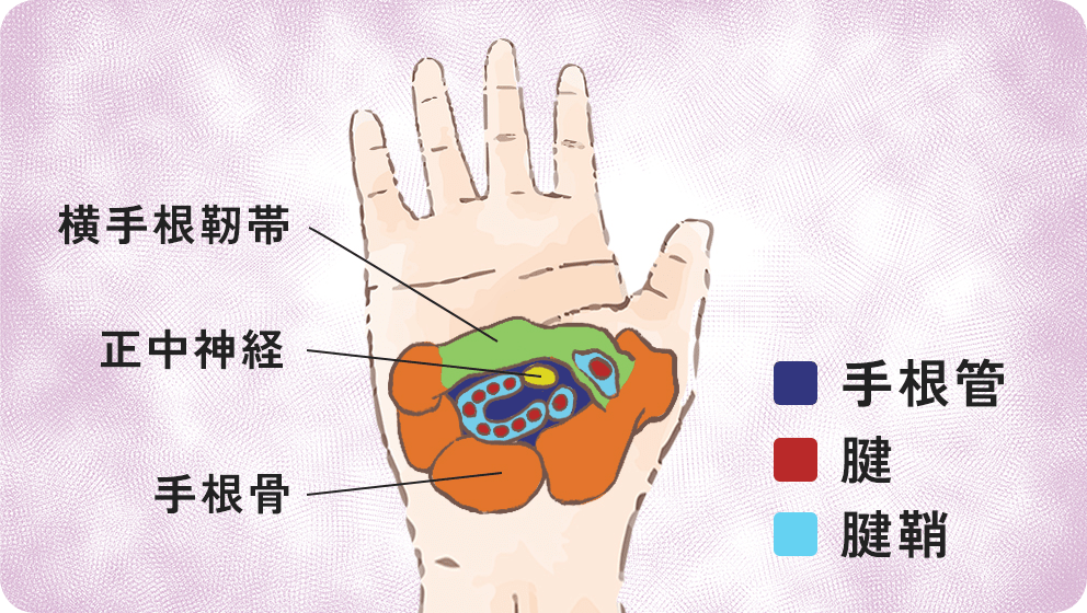 手をグーパーするとき、指が伸びないのは「ばね指」？ その解消法とは！新潟市中央区の整体 かんだ整骨院 弁天橋通