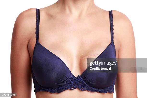 バストアップしたい女性がするべきこと 東京美容外科