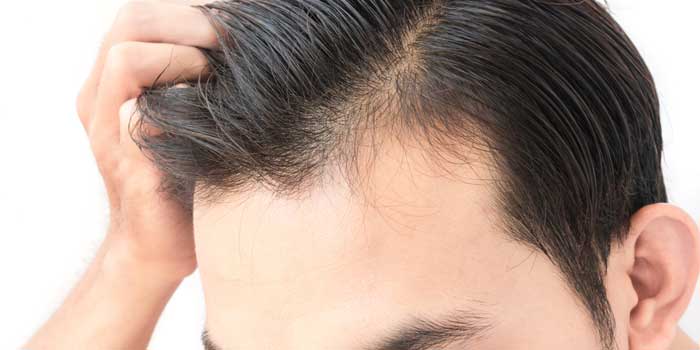 俺の生え際 薄すぎッ！！の写真素材12286967- PIXTA