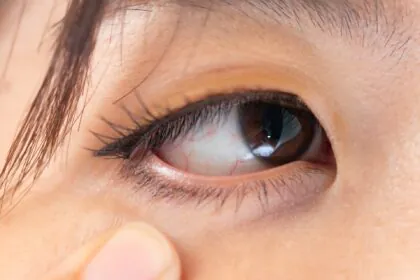 子どもの目の病気について三重県鈴鹿市で緑内障検診・斜視・弱視の相談と治療、コンタクトレンズ処方なら 野町どい眼科