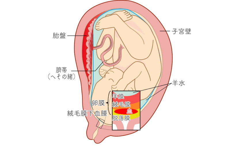 双胎妊娠の診断と管理』
