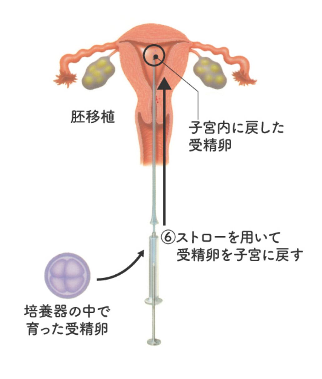 体外受精国立国際医療研究センター病院