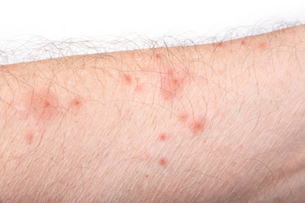 ダニが増えるNG行動をしていない？体がムズムズするなら“ダニの仕業”かも 秋こそ重要な予防と対策FNNプライムオンライン