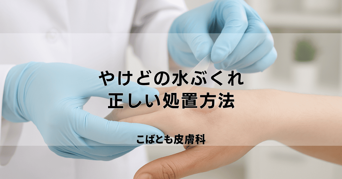 やけど 低温熱傷を含むひふのクリニック人形町