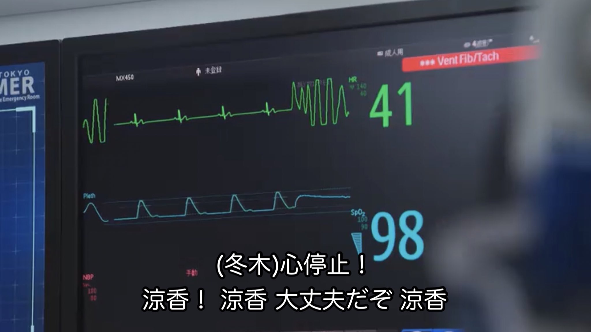 誘導法の基本と心電図波形が描かれる原則 ハート先生の心電図特集②エキスパートナースweb