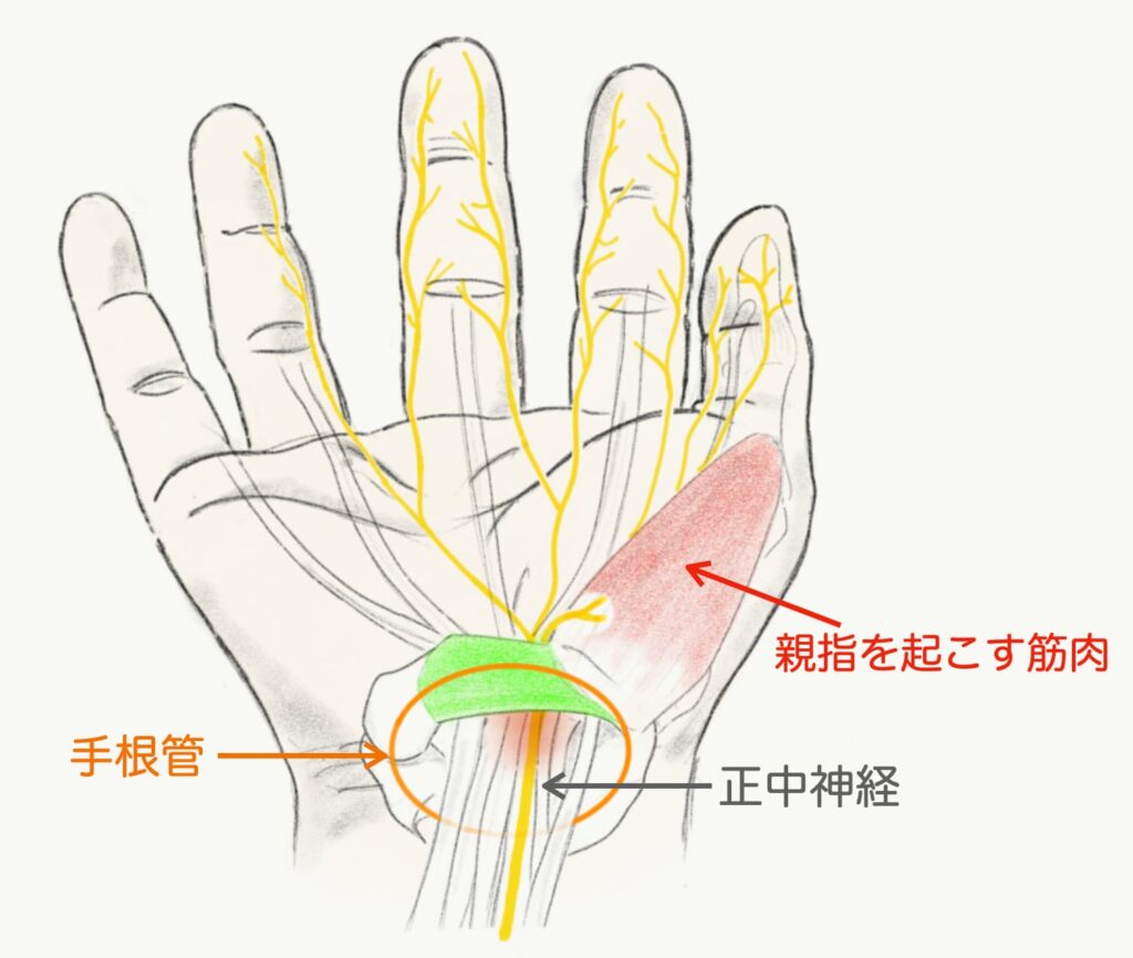 手根管症候群みわ内科クリニック