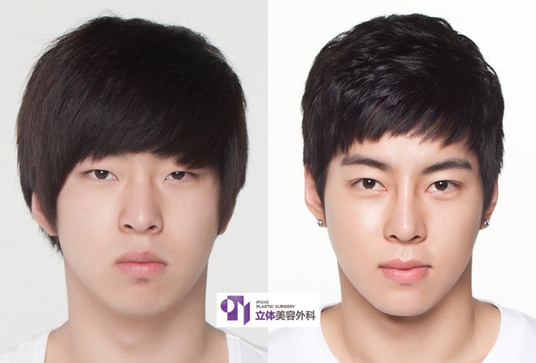 男性の頬骨縮小小木曽クリニック 美容外科・美容整形