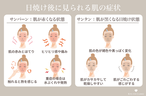 日焼けで皮がむける理由と対処法！適切なケアで皮膚を守ろう - カラリアマガジン - 香り専門メディア