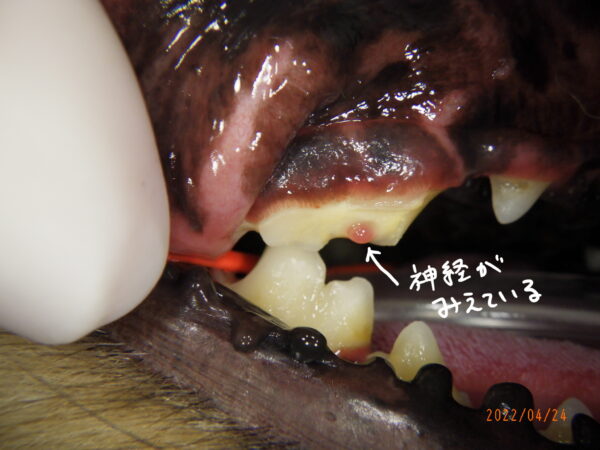 犬歯を削るとどうなるの？犬歯の役割・失った場合の対処法・八重歯との違いについて解説メディカルドック