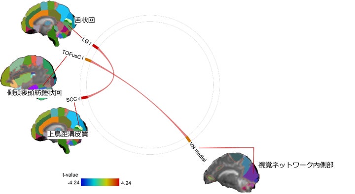 お口のおはなし 9月号 舌にあらわれる体の不調・舌は全身の状態を写すもの！？入間郡三芳町の歯科医院 ユナイトみよし歯科