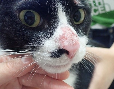 このポツポツ、実はカビかも👨🏻‍⚕️なかなか体の吹き出物が治らない😥という方 それ実はカビが原因かもしれません💦体にできるポツポツは、ニキビであることが1番多いですが マラセチア毛包炎の場合もあります！ ニキビとマラセチア毛包炎は治療も異なるため診断が