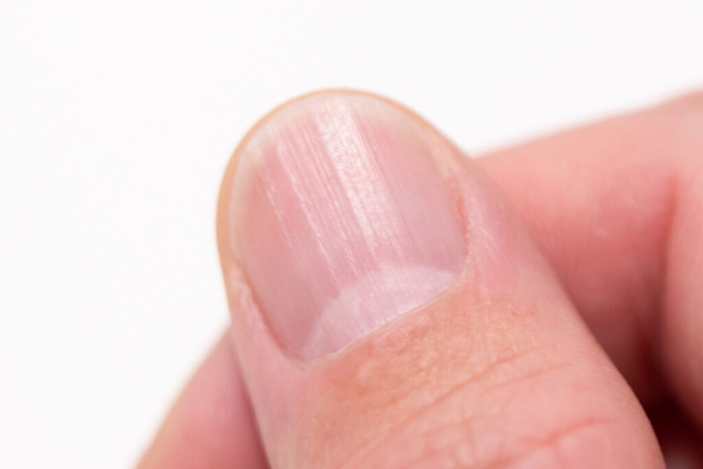 針を使わない美容成分導入 奇跡のハンドトリートメント 神戸市東灘区プライべ―トネイルサロン