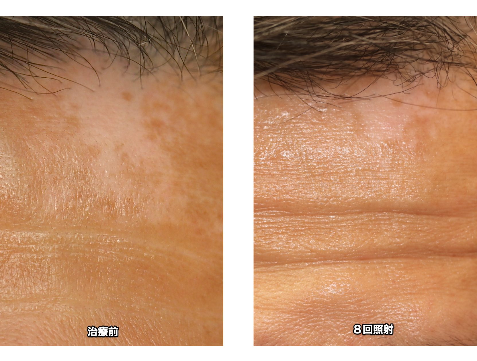 情報源 患者情報 005