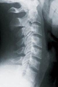 その腰痛、本当に大丈夫？見逃し厳禁！危険な5つの警告サイン中山クリニック明石市の整形外科・再生医療・腱板断裂治療の専門医