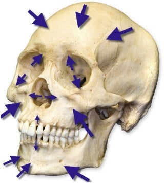 頭蓋骨の老化」に合わせた新しいメニュー 美鼻+エイジング子顔矯正 の導入鼻を高く小顔に 鼻を美しく整える ～新・隆鼻矯正術～