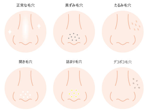 頭皮イラスト無料イラスト・フリー素材なら「イラストAC」