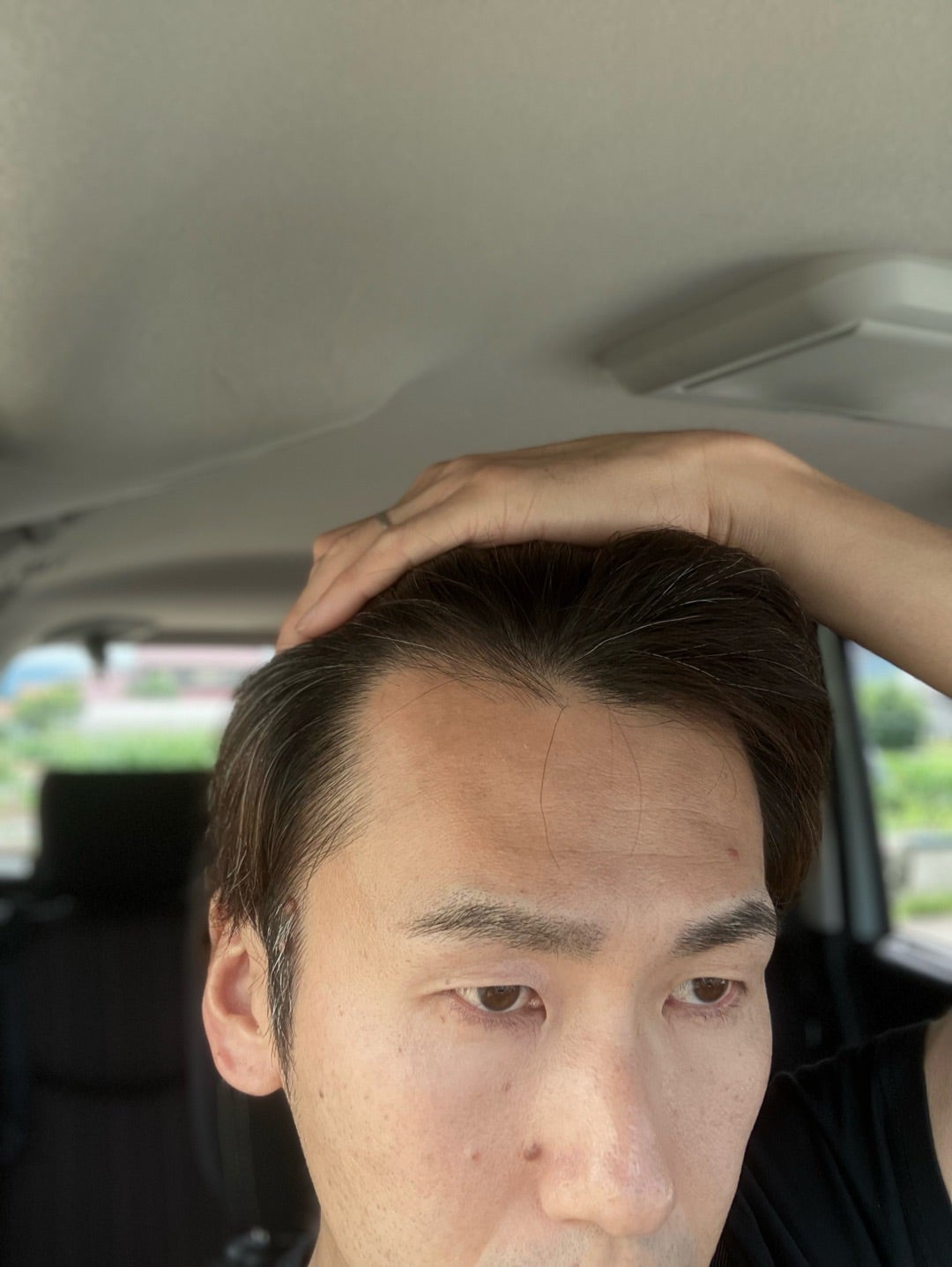 くせ毛と男性ホルモンゆるっとトランスジェンダーブログ