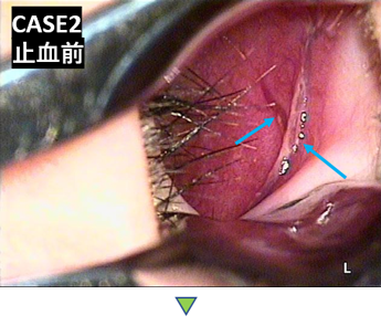 見てわかる鼻の病気 耳鼻咽喉科内藤クリニック