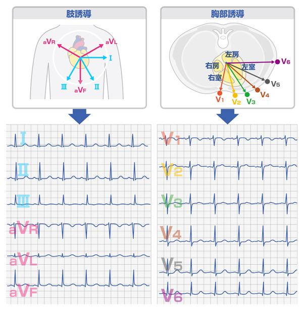 モニター心電図 正しい貼り方！管理の方法！ 看護師