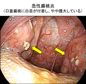 のどの病気と治療 - 仙台駅北口耳鼻咽喉科