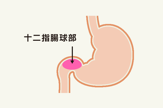 胃がん発見の為の胃カメラ検査の有用性