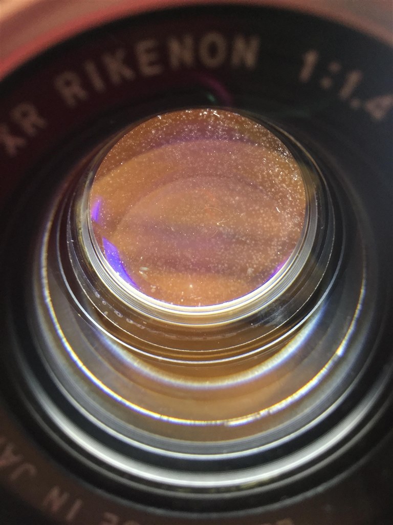 交換レンズ難病の治療