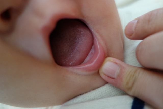 赤ちゃんの歯の生える順番が違う!?正しい順番や歯並びへの影響を知ろう - なごみ小児歯科クリニック