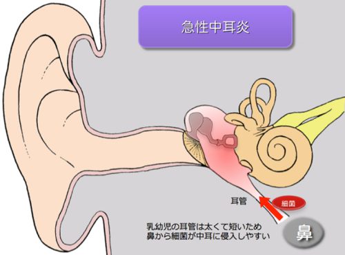 耳の症状 – 耳が痛い・耳がかゆい大田区蒲田のてらお耳鼻咽喉科クリニック