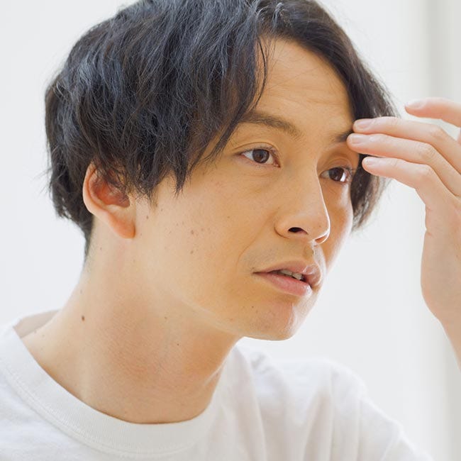 美容師監修 薄毛のメンズにおすすめの髪型15選！スタイリングのコツも伝授 - OZmall