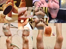 新宿駅でフットケアが人気のネイルサロンホットペッパービューティ