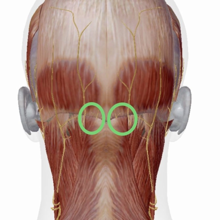 頭痛に悩まされている方へ 片頭痛 群発頭痛 緊張型頭痛
