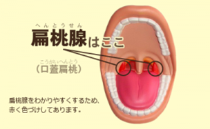扁桃腺 へんとうせん って、どこのこと？子肌育Blog アトピーに負けない生活
