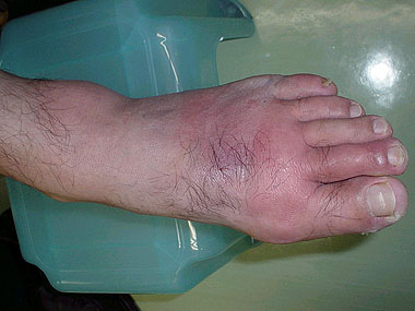 痛風さかい整形外科 公式 練馬区 江古田駅から徒歩3分の整形外科 リハビリテーション科