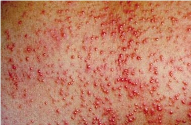 子どもがかかる症状と対策くすりと健康の情報局