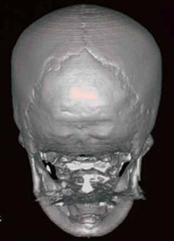 老人頭蓋モデル日本スリービー・サイエンティフィック