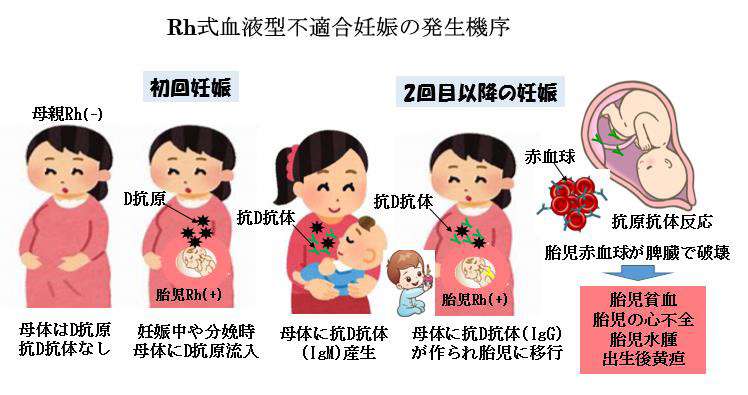 血液型不適合だと子どもができにくい？│ 医師監修 ジネコ不妊治療情報