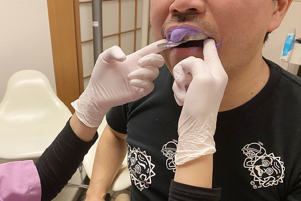 歯型の写真素材写真素材なら「写真AC」無料 フリー ダウンロードOK