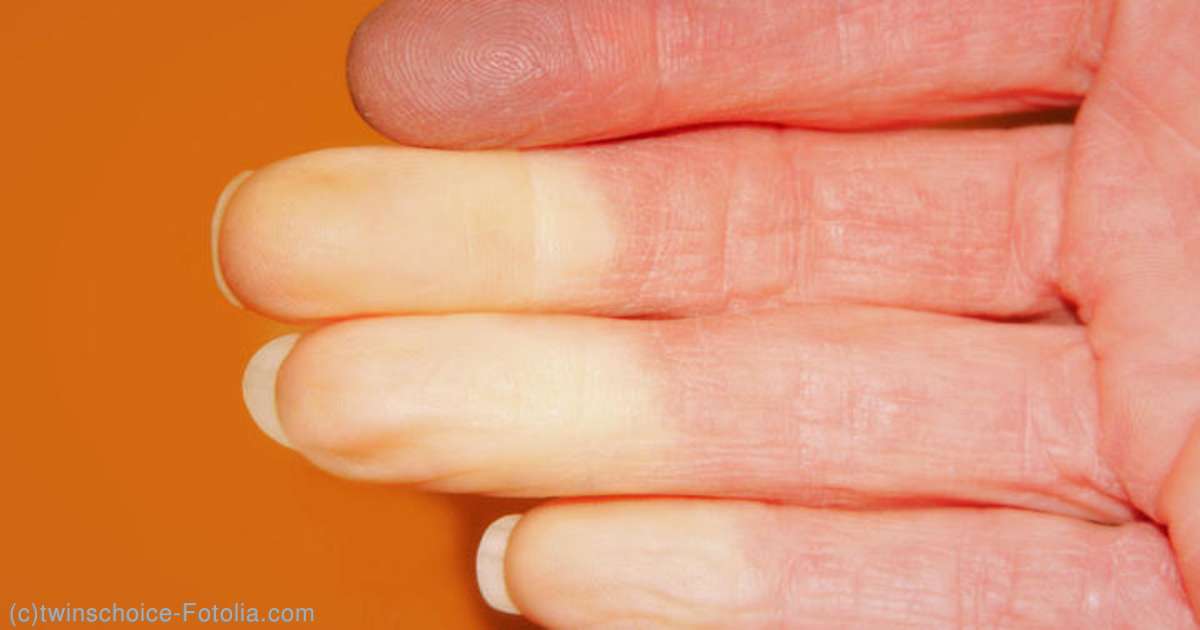 ひょう疽 ひょうそ の症状 治療方法について - 渋谷駅前おおしま皮膚科