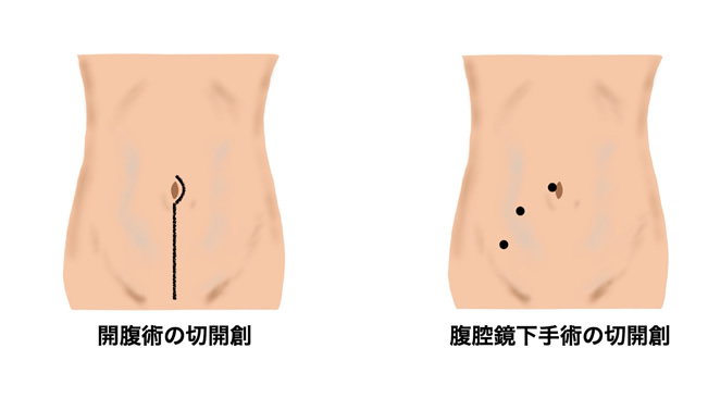 おヘソが大変！: 泌尿器科の常識と盲点