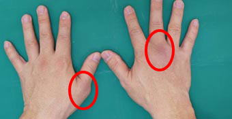 親指の付け根が痛い時の、手のリンパマッサージとツボ押しのやり方コラム銀座ナチュラルタイム-銀座駅から徒歩1分の極上リンパマッサージ